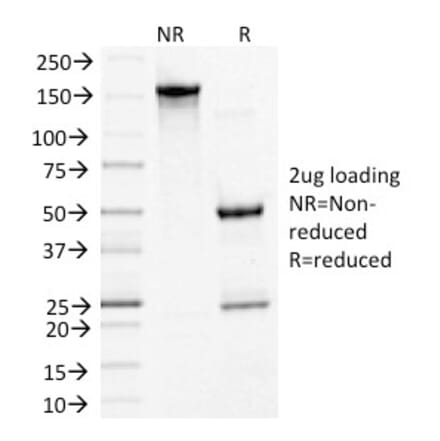 SDS-PAGE - Anti-Desmoglein 3 Antibody [5G11] - BSA and Azide free (A251555) - Antibodies.com
