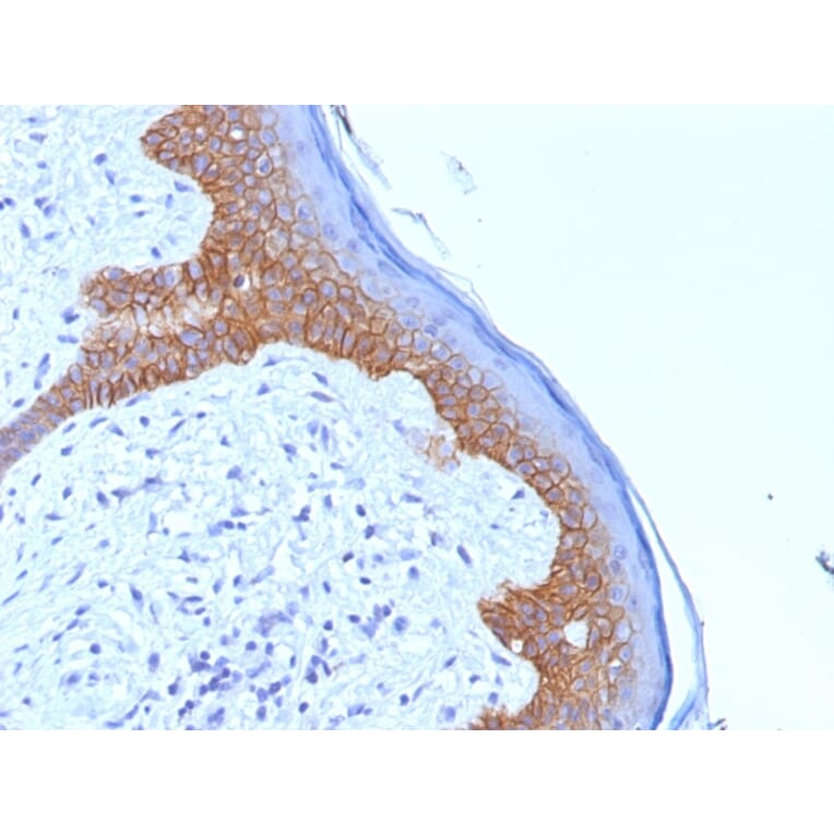 Immunohistochemistry - Anti-Desmoglein 3 Antibody [5G11] - BSA and Azide free (A251554) - Antibodies.com