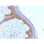 Immunohistochemistry - Anti-Desmoglein 3 Antibody [5G11] - BSA and Azide free (A251554) - Antibodies.com