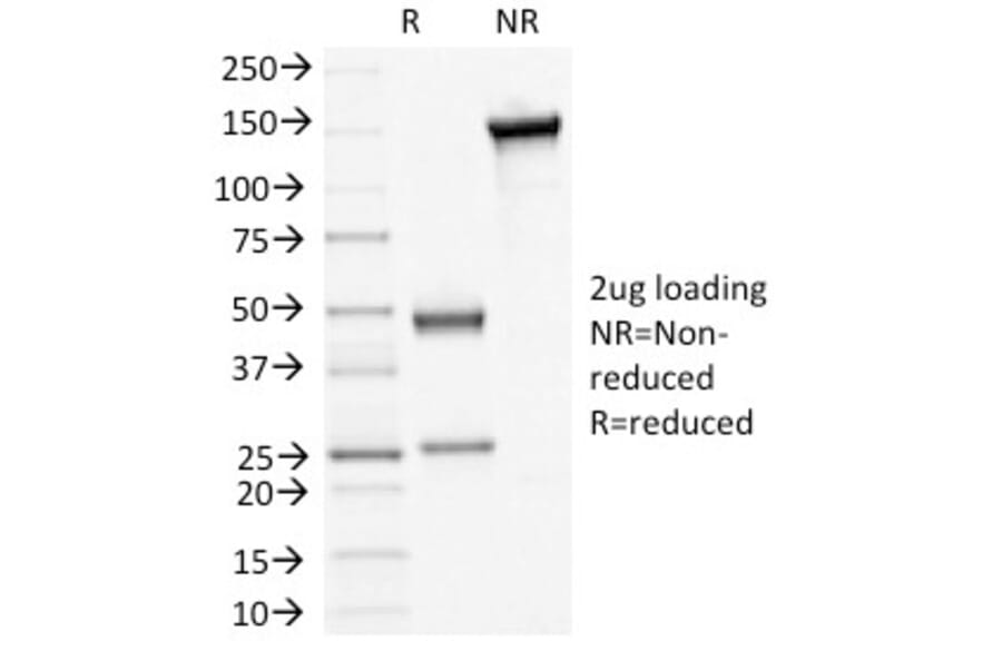 SDS-PAGE - Anti-Desmoglein 3 Antibody [5H10] - BSA and Azide free (A251555) - Antibodies.com