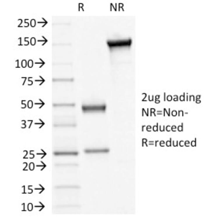 SDS-PAGE - Anti-Desmoglein 3 Antibody [5H10] - BSA and Azide free (A251555) - Antibodies.com