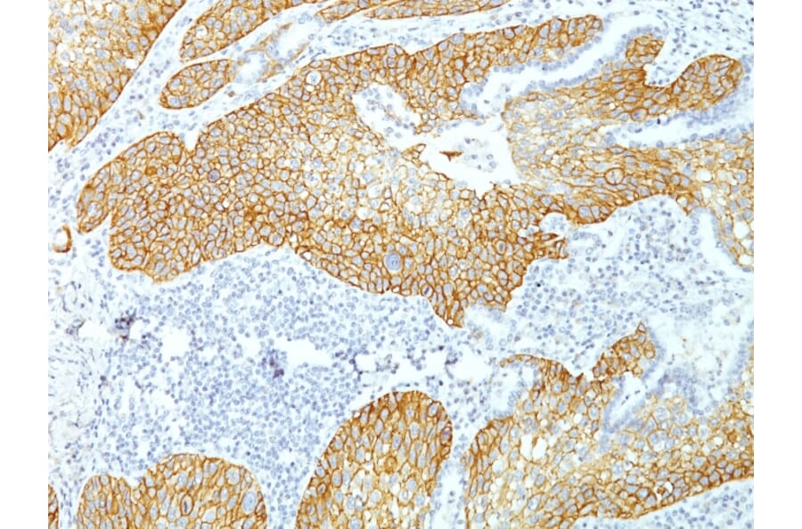 Immunohistochemistry - Anti-Desmoglein 3 Antibody [DSG3/1535] - BSA and Azide free (A251556) - Antibodies.com