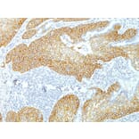 Immunohistochemistry - Anti-Desmoglein 3 Antibody [DSG3/1535] - BSA and Azide free (A251556) - Antibodies.com