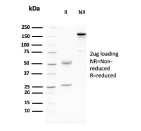 SDS-PAGE - Anti-Desmoglein 3 Antibody [DSG3/2796] - BSA and Azide free (A251558) - Antibodies.com