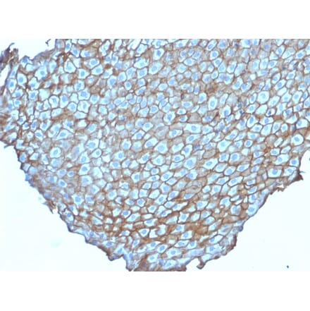 Immunohistochemistry - Anti-Desmoglein 3 Antibody [DSG3/2838] - BSA and Azide free (A251560) - Antibodies.com