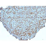 Immunohistochemistry - Anti-Desmoglein 3 Antibody [DSG3/2838] - BSA and Azide free (A251560) - Antibodies.com
