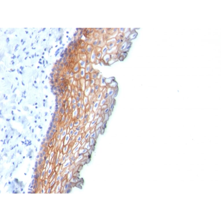 Immunohistochemistry - Anti-Desmoglein 3 Antibody [DSG3/2838] - BSA and Azide free (A251560) - Antibodies.com