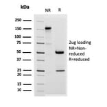 SDS-PAGE - Anti-Desmoglein 3 Antibody [DSG3/2838] - BSA and Azide free (A251560) - Antibodies.com