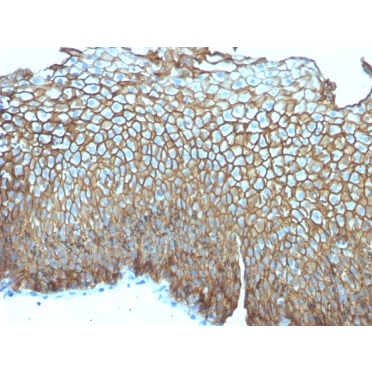 Immunohistochemistry - Anti-Desmoglein 3 Antibody [DSG3/2839] - BSA and Azide free (A251561) - Antibodies.com