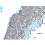Immunohistochemistry - Anti-Desmoglein 3 Antibody [DSG3/2839] - BSA and Azide free (A251561) - Antibodies.com