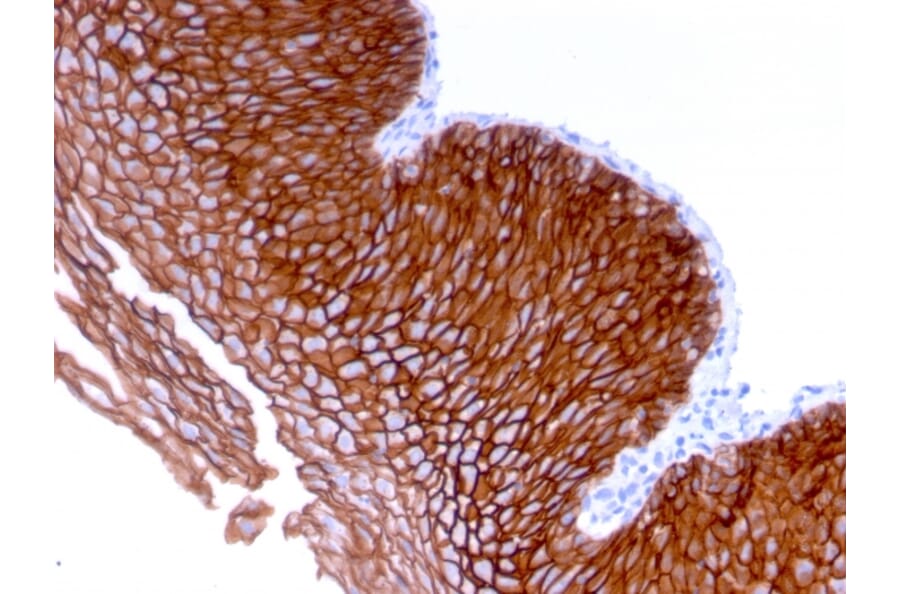 Immunohistochemistry - Anti-Desmoglein 3 Antibody [DSG3/2839] - BSA and Azide free (A251561) - Antibodies.com