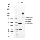 SDS-PAGE - Anti-Desmoglein 3 Antibody [DSG3/2839] - BSA and Azide free (A251561) - Antibodies.com