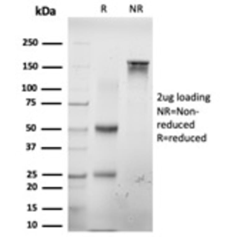 SDS-PAGE - Anti-E2F6 Antibody [PCRP-E2F6-1F8] - BSA and Azide free (A251562) - Antibodies.com