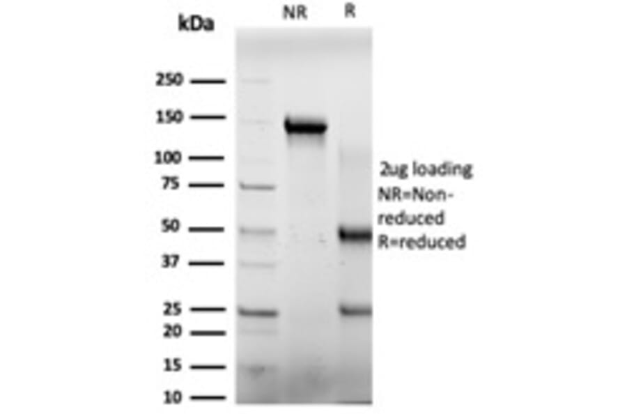 SDS-PAGE - Anti-E4F1 Antibody [PCRP-E4F1-2D1] - BSA and Azide free (A251563) - Antibodies.com