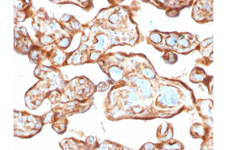 Immunohistochemistry - Anti-Thymidine Phosphorylase Antibody [P-GF.44C] - BSA and Azide free (A251563) - Antibodies.com