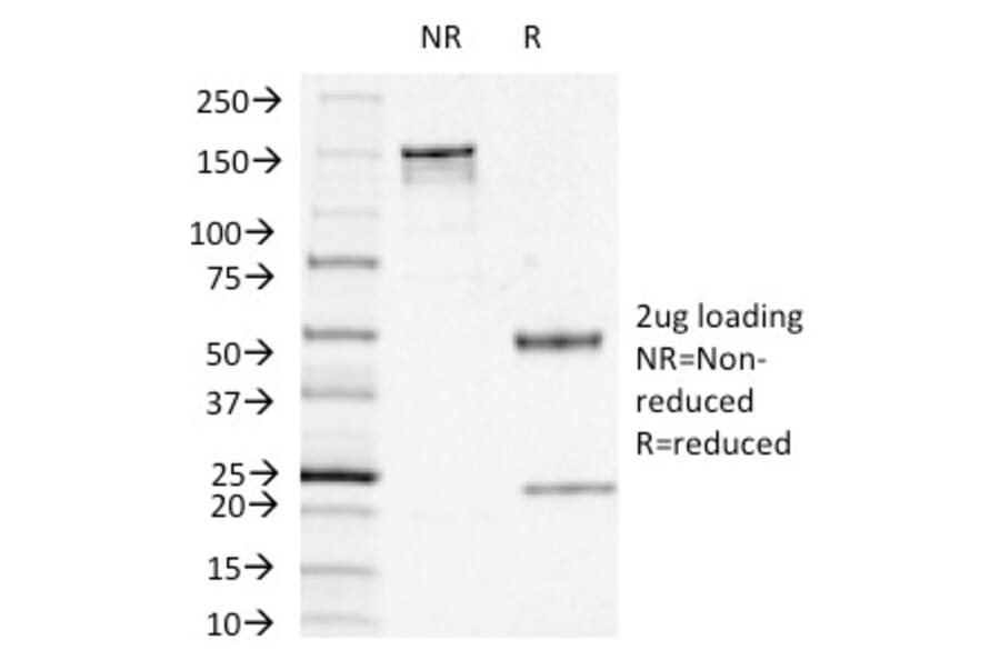 SDS-PAGE - Anti-Thymidine Phosphorylase Antibody [P-GF.44C] - BSA and Azide free (A251564) - Antibodies.com