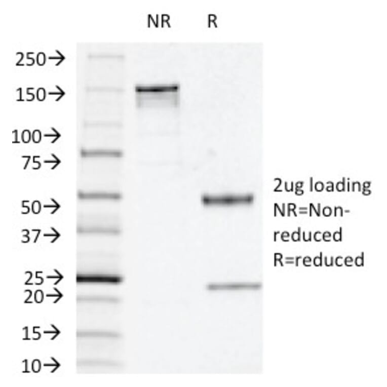 SDS-PAGE - Anti-Thymidine Phosphorylase Antibody [P-GF.44C] - BSA and Azide free (A251564) - Antibodies.com