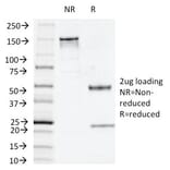 SDS-PAGE - Anti-Thymidine Phosphorylase Antibody [P-GF.44C] - BSA and Azide free (A251564) - Antibodies.com