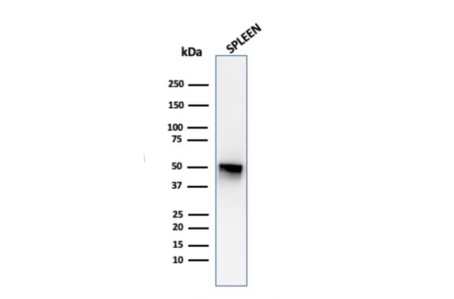 Western Blot - Anti-Thymidine Phosphorylase Antibody [P-GF.44C] - BSA and Azide free (A251564) - Antibodies.com