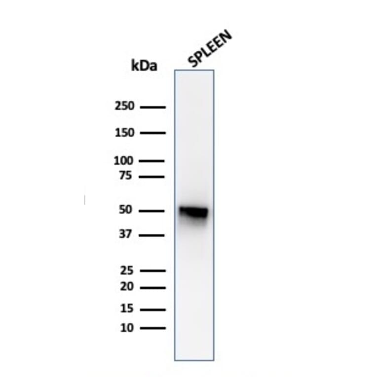 Western Blot - Anti-Thymidine Phosphorylase Antibody [P-GF.44C] - BSA and Azide free (A251564) - Antibodies.com