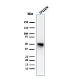 Western Blot - Anti-Thymidine Phosphorylase Antibody [P-GF.44C] - BSA and Azide free (A251564) - Antibodies.com