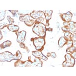 Immunohistochemistry - Anti-Thymidine Phosphorylase Antibody [SPM322] - BSA and Azide free (A251564) - Antibodies.com