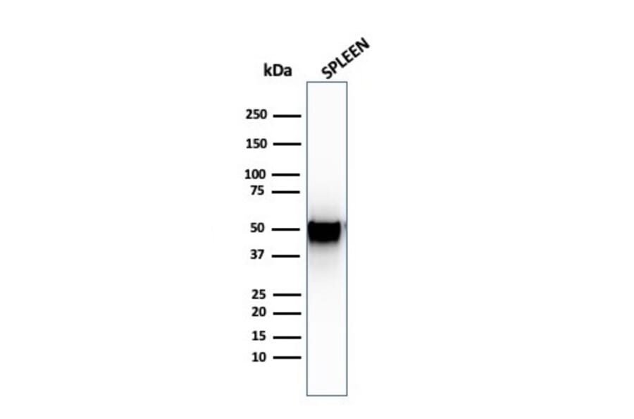 Western Blot - Anti-Thymidine Phosphorylase Antibody [SPM322] - BSA and Azide free (A251565) - Antibodies.com