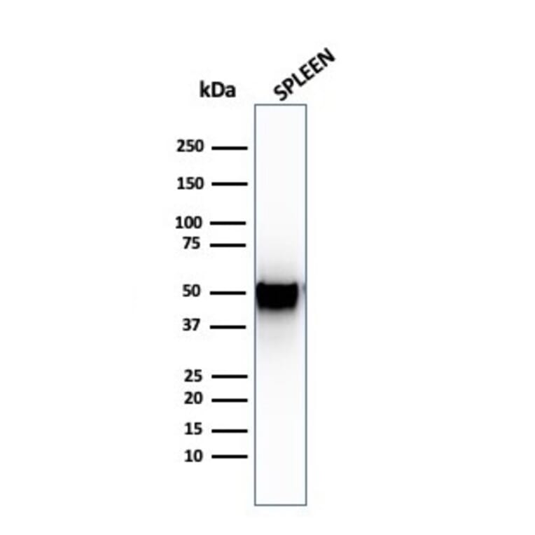 Western Blot - Anti-Thymidine Phosphorylase Antibody [SPM322] - BSA and Azide free (A251565) - Antibodies.com