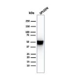 Western Blot - Anti-Thymidine Phosphorylase Antibody [SPM322] - BSA and Azide free (A251565) - Antibodies.com