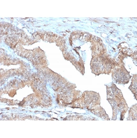Immunohistochemistry - Anti-Thymidine Phosphorylase Antibody [rTYMP/3444] - BSA and Azide free (A251565) - Antibodies.com