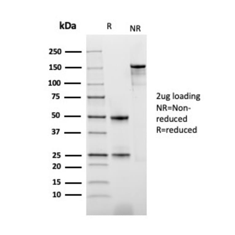 SDS-PAGE - Anti-Thymidine Phosphorylase Antibody [rTYMP/3444] - BSA and Azide free (A251566) - Antibodies.com