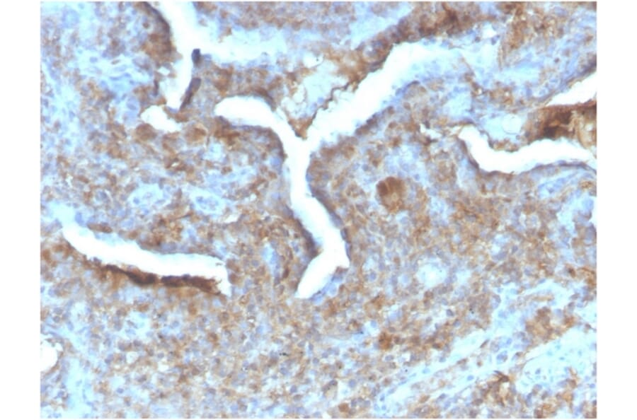 Immunohistochemistry - Anti-Thymidine Phosphorylase Antibody [TYMP/2890R] - BSA and Azide free (A251566) - Antibodies.com