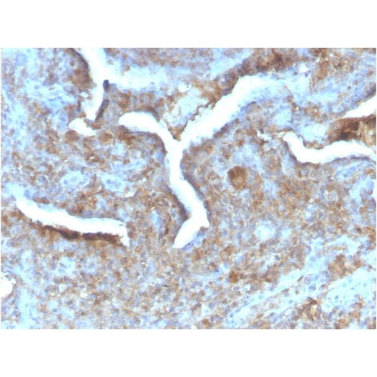 Immunohistochemistry - Anti-Thymidine Phosphorylase Antibody [TYMP/2890R] - BSA and Azide free (A251566) - Antibodies.com