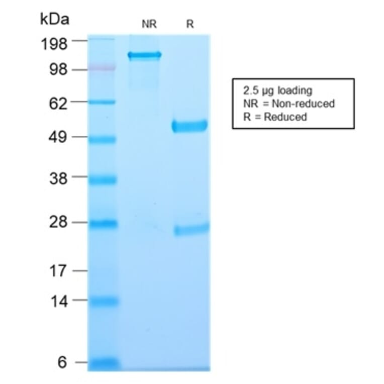 SDS-PAGE - Anti-Thymidine Phosphorylase Antibody [TYMP/2890R] - BSA and Azide free (A251567) - Antibodies.com