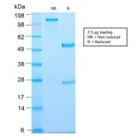 SDS-PAGE - Anti-Thymidine Phosphorylase Antibody [TYMP/2890R] - BSA and Azide free (A251567) - Antibodies.com