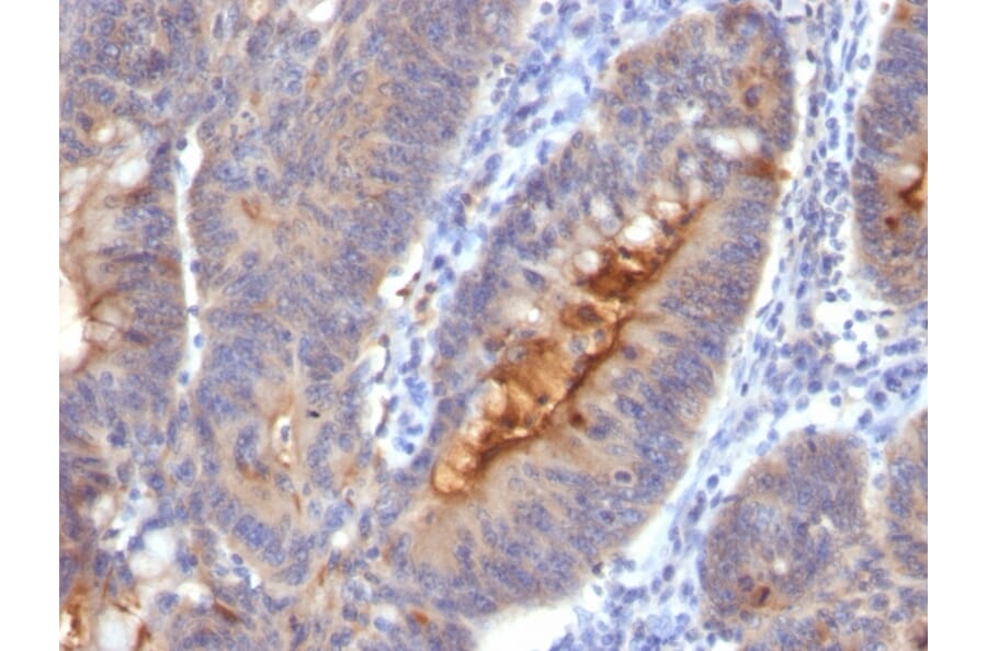Immunohistochemistry - Anti-ECM1 Antibody [SC05] - BSA and Azide free (A251567) - Antibodies.com