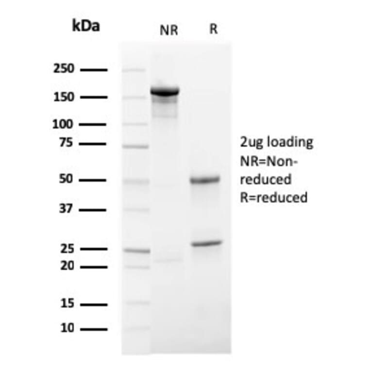 SDS-PAGE - Anti-ECM1 Antibody [SPM217] - BSA and Azide free (A251569) - Antibodies.com