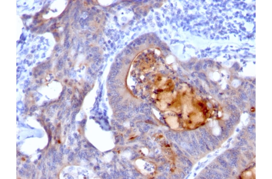 Immunohistochemistry - Anti-ECM1 Antibody [rECM1/792] - BSA and Azide free (A251570) - Antibodies.com