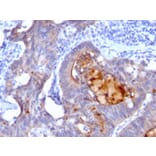 Immunohistochemistry - Anti-ECM1 Antibody [rECM1/792] - BSA and Azide free (A251570) - Antibodies.com