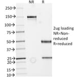 SDS-PAGE - Anti-ECM1 Antibody [rECM1/792] - BSA and Azide free (A251571) - Antibodies.com