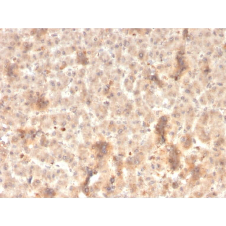 Immunohistochemistry - Anti-ECM1 Antibody [rSPM217] - BSA and Azide free (A251571) - Antibodies.com