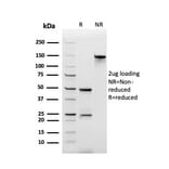 SDS-PAGE - Anti-ECM1 Antibody [rSPM217] - BSA and Azide free (A251572) - Antibodies.com