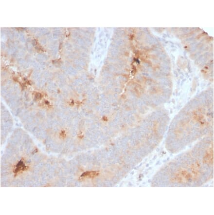 Immunohistochemistry - Anti-ECM1 Antibody [ECM1/2889R] - BSA and Azide free (A251572) - Antibodies.com