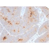 Immunohistochemistry - Anti-ECM1 Antibody [ECM1/2889R] - BSA and Azide free (A251572) - Antibodies.com