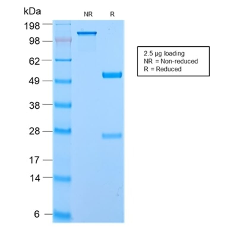 SDS-PAGE - Anti-ECM1 Antibody [ECM1/2889R] - BSA and Azide free (A251573) - Antibodies.com