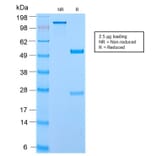 SDS-PAGE - Anti-ECM1 Antibody [ECM1/2889R] - BSA and Azide free (A251573) - Antibodies.com