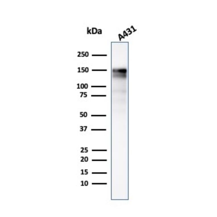 Western Blot - Anti-EGFR Antibody [GFR/2341] - BSA and Azide free (A251575) - Antibodies.com