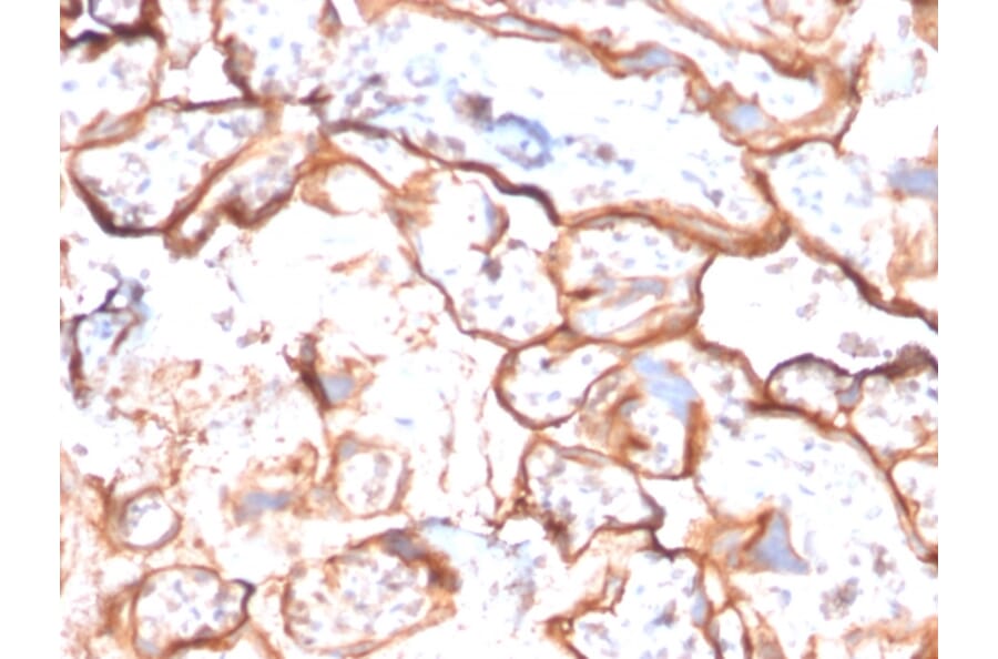 Immunohistochemistry - Anti-EGFR Antibody [GFR/2596] - BSA and Azide free (A251577) - Antibodies.com
