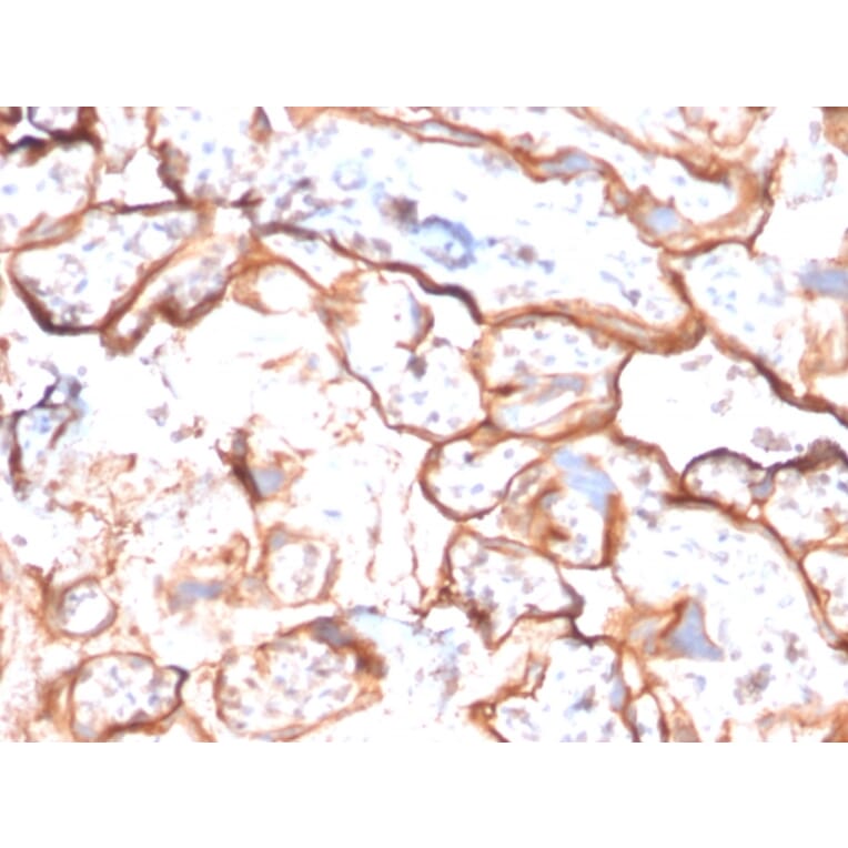 Immunohistochemistry - Anti-EGFR Antibody [GFR/2596] - BSA and Azide free (A251577) - Antibodies.com