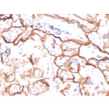 Immunohistochemistry - Anti-EGFR Antibody [GFR/2596] - BSA and Azide free (A251577) - Antibodies.com